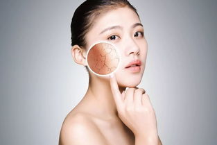 敏感皮肤是干性皮肤吗的简单介绍,敏感皮肤是干性皮肤吗的简单介绍,第2张