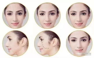 脸上皮肤松弛吃什么好(脸上皮肤松弛下垂吃什么保健品好),第3张 脸上皮肤松弛吃什么好(脸上皮肤松弛下垂吃什么保健品好),脸上皮肤松弛吃什么好(脸上皮肤松弛下垂吃什么保健品好),第3张