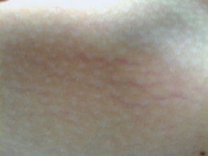 皮肤黄白该染什么颜色好看图片(皮肤白黄怎么回事),第3张 皮肤黄白该染什么颜色好看图片(皮肤白黄怎么回事),皮肤黄白该染什么颜色好看图片(皮肤白黄怎么回事),第3张