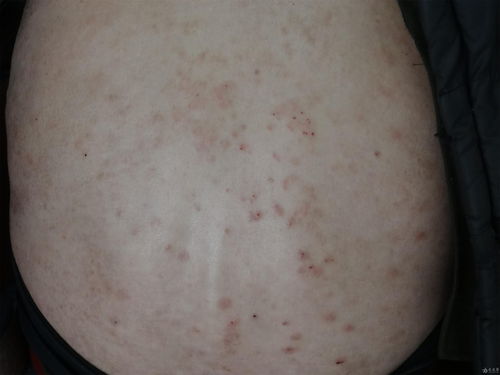 豆腐对皮肤的作用与功效(吃豆腐对皮肤病好吗),第3张 豆腐对皮肤的作用与功效(吃豆腐对皮肤病好吗),豆腐对皮肤的作用与功效(吃豆腐对皮肤病好吗),第3张