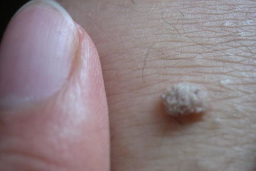 隆森橱柜(隆森橱柜还在北京吗),第1张 隆森橱柜(隆森橱柜还在北京吗),隆森橱柜(隆森橱柜还在北京吗),第1张