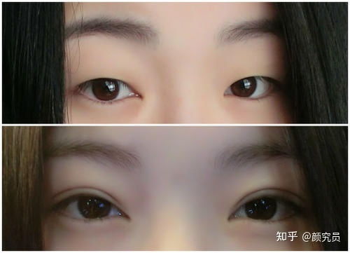 皮肤松弛眼突(眼部皮肤松弛怎么办 妙招教你巧解决),第3张 皮肤松弛眼突(眼部皮肤松弛怎么办 妙招教你巧解决),皮肤松弛眼突(眼部皮肤松弛怎么办 妙招教你巧解决),第3张