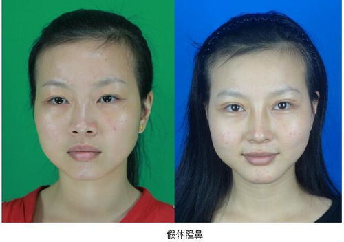 cng减压器（cng减压器如何调出色的卓越的优异的杰出的）,cng减压器（cng减压器如何调出色的卓越的优异的杰出的）,第1张