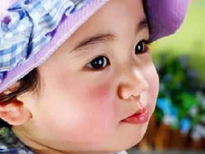 皮肤毛躁发红(皮肤发红毛糙),第2张 皮肤毛躁发红(皮肤发红毛糙),皮肤毛躁发红(皮肤发红毛糙),第2张