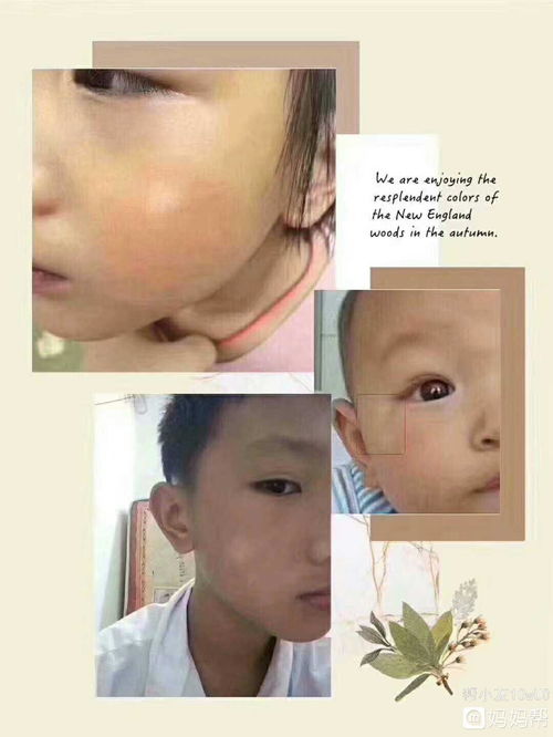 大理石结晶粉(大理石结晶粉结晶流程),第3张 大理石结晶粉(大理石结晶粉结晶流程),大理石结晶粉(大理石结晶粉结晶流程),第3张