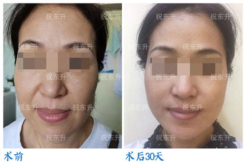 脸上皮肤松弛吃什么好(脸上皮肤松弛下垂吃什么保健品好),第2张 脸上皮肤松弛吃什么好(脸上皮肤松弛下垂吃什么保健品好),脸上皮肤松弛吃什么好(脸上皮肤松弛下垂吃什么保健品好),第2张