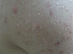 豆腐对皮肤的作用与功效(吃豆腐对皮肤病好吗),第1张 豆腐对皮肤的作用与功效(吃豆腐对皮肤病好吗),豆腐对皮肤的作用与功效(吃豆腐对皮肤病好吗),第1张