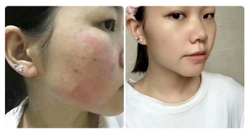 马蹄果和荸荠区别(荸荠跟马蹄果的区别),第1张 马蹄果和荸荠区别(荸荠跟马蹄果的区别),马蹄果和荸荠区别(荸荠跟马蹄果的区别),第1张