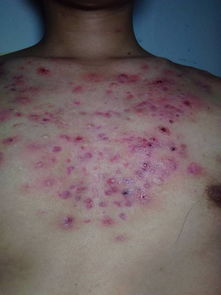 豆腐对皮肤的作用与功效(吃豆腐对皮肤病好吗),第2张 豆腐对皮肤的作用与功效(吃豆腐对皮肤病好吗),豆腐对皮肤的作用与功效(吃豆腐对皮肤病好吗),第2张