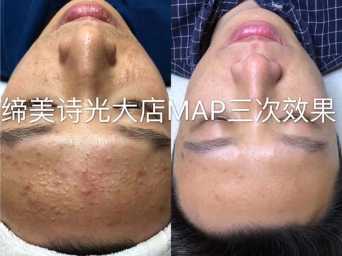 家装装修报价(家装装修报价清单表),第1张 家装装修报价(家装装修报价清单表),家装装修报价(家装装修报价清单表),第1张