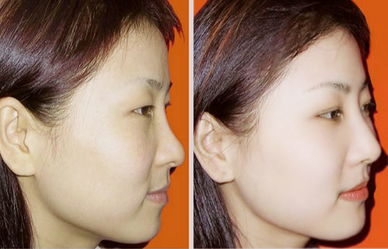 有皮肤黑的明星(皮肤黑的明星怎么变白),第1张 有皮肤黑的明星(皮肤黑的明星怎么变白),有皮肤黑的明星(皮肤黑的明星怎么变白),第1张