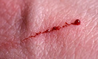 皮肤再生管理怎么做(皮肤再生修复),第3张 皮肤再生管理怎么做(皮肤再生修复),皮肤再生管理怎么做(皮肤再生修复),第3张