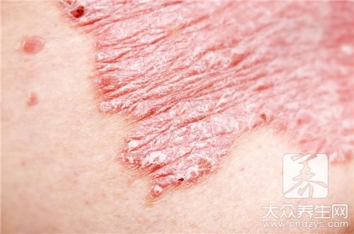 靠前壮阳食物排行榜（靠前壮阳食物排行榜）,靠前壮阳食物排行榜（靠前壮阳食物排行榜）,第1张