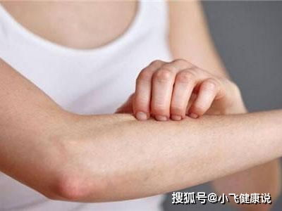 夏天皮肤过敏瘙痒怎么办(夏天皮肤过敏瘙痒怎么办呢),第2张 夏天皮肤过敏瘙痒怎么办(夏天皮肤过敏瘙痒怎么办呢),夏天皮肤过敏瘙痒怎么办(夏天皮肤过敏瘙痒怎么办呢),第2张