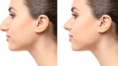 什么方法可以改善皮肤发红（有什么可以改善皮肤的方法）,什么方法可以改善皮肤发红（有什么可以改善皮肤的方法）,第1张