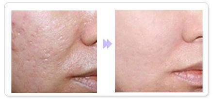 脸看起来很油皮肤粗糙(脸的皮肤粗糙油腻怎么办),第3张 脸看起来很油皮肤粗糙(脸的皮肤粗糙油腻怎么办),脸看起来很油皮肤粗糙(脸的皮肤粗糙油腻怎么办),第3张