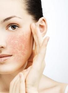 上海江城皮肤病医院祛斑怎么样的简单介绍,第3张 上海江城皮肤病医院祛斑怎么样的简单介绍,上海江城皮肤病医院祛斑怎么样的简单介绍,第3张