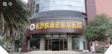 长沙皮肤么(长沙最好的皮肤医院),第1张 长沙皮肤么(长沙最好的皮肤医院),长沙皮肤么(长沙最好的皮肤医院),第1张