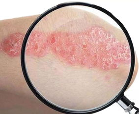 皮肤表面细胞活(皮肤表皮细胞),第2张 皮肤表面细胞活(皮肤表皮细胞),皮肤表面细胞活(皮肤表皮细胞),第2张