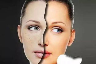 消除皮肤色斑(去除皮肤色斑的中药有哪些),第1张 消除皮肤色斑(去除皮肤色斑的中药有哪些),消除皮肤色斑(去除皮肤色斑的中药有哪些),第1张