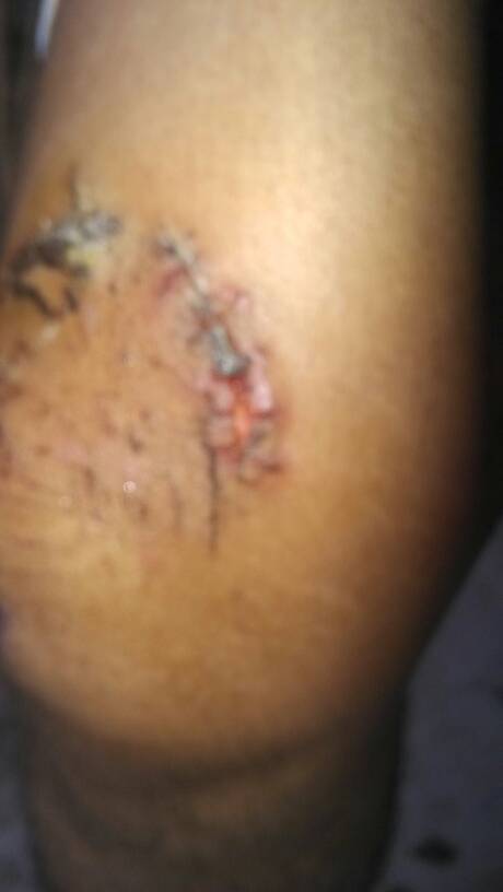 色弱图(色弱图谱全套图),第1张 色弱图(色弱图谱全套图),色弱图(色弱图谱全套图),第1张