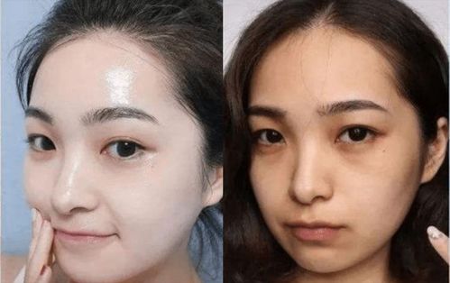 怎样才能让脸部的皮肤变湿润(怎么让脸变湿润),第1张 怎样才能让脸部的皮肤变湿润(怎么让脸变湿润),怎样才能让脸部的皮肤变湿润(怎么让脸变湿润),第1张