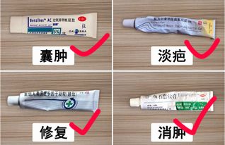 皮肤有痘痘炎症怎么办(皮肤有痘痘炎症怎么办用什么药),第3张 皮肤有痘痘炎症怎么办(皮肤有痘痘炎症怎么办用什么药),皮肤有痘痘炎症怎么办(皮肤有痘痘炎症怎么办用什么药),第3张