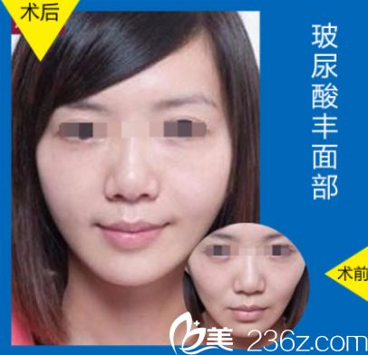 整容医院能让皮肤变白(整容院可以修复皮肤吗),第3张 整容医院能让皮肤变白(整容院可以修复皮肤吗),整容医院能让皮肤变白(整容院可以修复皮肤吗),第3张