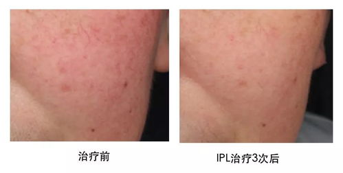 长安福特新福克斯两厢(长安福特福克斯两厢车图片),第1张 长安福特新福克斯两厢(长安福特福克斯两厢车图片),长安福特新福克斯两厢(长安福特福克斯两厢车图片),第1张