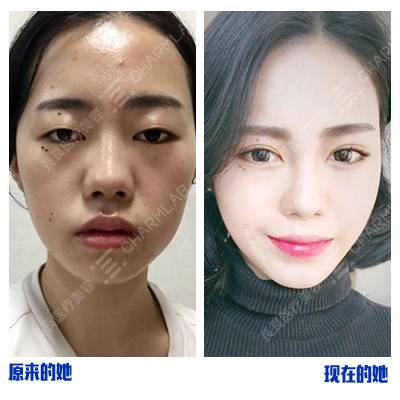 去痣整形外科皮肤科(去痣整形外科皮肤科看什么),第3张 去痣整形外科皮肤科(去痣整形外科皮肤科看什么),去痣整形外科皮肤科(去痣整形外科皮肤科看什么),第3张