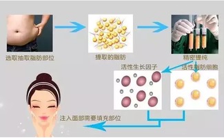 整容医院能让皮肤变白(整容院可以修复皮肤吗),第2张 整容医院能让皮肤变白(整容院可以修复皮肤吗),整容医院能让皮肤变白(整容院可以修复皮肤吗),第2张