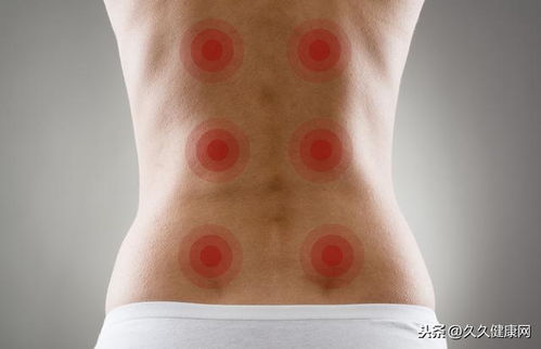 腹部的拔罐减肥方法(腹部拔罐减肥的位置图),第1张 腹部的拔罐减肥方法(腹部拔罐减肥的位置图),腹部的拔罐减肥方法(腹部拔罐减肥的位置图),第1张