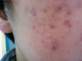 装潢:模具制作的必备材料——石膏粉是什么?如何使用?,第3张 装潢:模具制作的必备材料——石膏粉是什么?如何使用?,装潢:模具制作的必备材料——石膏粉是什么?如何使用?,第3张