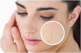 干性皮肤变好的小常识(干性皮肤变好的小常识图片),第1张 干性皮肤变好的小常识(干性皮肤变好的小常识图片),干性皮肤变好的小常识(干性皮肤变好的小常识图片),第1张