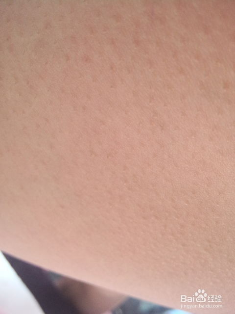 鸡皮肤会好嘛(鸡皮肤会好吗),第3张 鸡皮肤会好嘛(鸡皮肤会好吗),鸡皮肤会好嘛(鸡皮肤会好吗),第3张