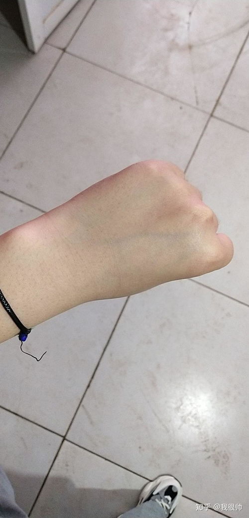 皮肤黑暗黄怎么美白(皮肤黑黄怎么内调变白),第1张 皮肤黑暗黄怎么美白(皮肤黑黄怎么内调变白),皮肤黑暗黄怎么美白(皮肤黑黄怎么内调变白),第1张