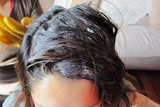 染发水碰到皮肤上出现白的怎么办（染发剂弄到皮肤上变白了怎么办）,染发水碰到皮肤上出现白的怎么办（染发剂弄到皮肤上变白了怎么办）,第2张