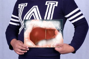 养肝护肝多喝这6种茶(肝不好的人有三黑两臭),第2张 养肝护肝多喝这6种茶(肝不好的人有三黑两臭),养肝护肝多喝这6种茶(肝不好的人有三黑两臭),第2张