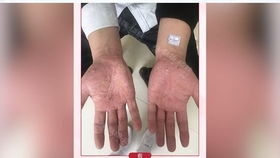 西安哪些医院有皮肤科（西安哪些医院皮肤科比较好）,西安哪些医院有皮肤科（西安哪些医院皮肤科比较好）,第1张