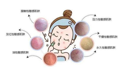 春天皮肤过敏(春天皮肤过敏小偏方),第2张 春天皮肤过敏(春天皮肤过敏小偏方),春天皮肤过敏(春天皮肤过敏小偏方),第2张