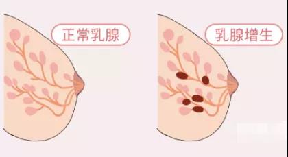 乳腺增生禁忌五种水果(乳腺结节最怕三种茶),第1张 乳腺增生禁忌五种水果(乳腺结节最怕三种茶),乳腺增生禁忌五种水果(乳腺结节最怕三种茶),第1张