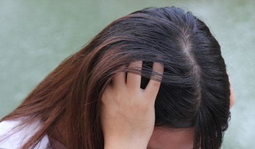 皮肤干的人头发掉(皮肤干的人头发掉的厉害),第3张 皮肤干的人头发掉(皮肤干的人头发掉的厉害),皮肤干的人头发掉(皮肤干的人头发掉的厉害),第3张