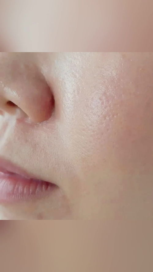 皮肤油有啥好处吗(皮肤油爱长痘是什么原因),第2张 皮肤油有啥好处吗(皮肤油爱长痘是什么原因),皮肤油有啥好处吗(皮肤油爱长痘是什么原因),第2张