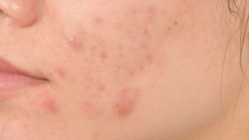 皮肤修复怎么像过敏(皮肤修复怎么像过敏一样),第2张 皮肤修复怎么像过敏(皮肤修复怎么像过敏一样),皮肤修复怎么像过敏(皮肤修复怎么像过敏一样),第2张