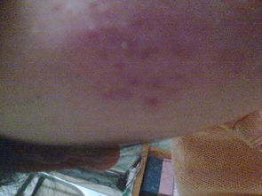 皮肤越来越糙怎么办(皮肤太糙怎么办),第2张 皮肤越来越糙怎么办(皮肤太糙怎么办),皮肤越来越糙怎么办(皮肤太糙怎么办),第2张