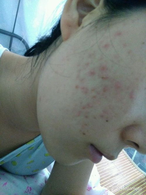 宜春好的治皮肤病医院(宜春哪里的皮肤科比较好),第1张 宜春好的治皮肤病医院(宜春哪里的皮肤科比较好),宜春好的治皮肤病医院(宜春哪里的皮肤科比较好),第1张