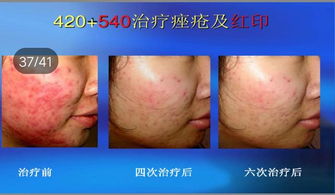 泉州交通事故（泉州2021车祸）,泉州交通事故（泉州2021车祸）,第2张