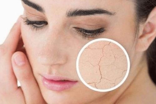 皮肤粗糙干燥毛孔大什么化妆品好(皮肤粗糙毛孔粗大用什么化妆品),第2张 皮肤粗糙干燥毛孔大什么化妆品好(皮肤粗糙毛孔粗大用什么化妆品),皮肤粗糙干燥毛孔大什么化妆品好(皮肤粗糙毛孔粗大用什么化妆品),第2张