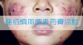 皮肤有痘痘炎症怎么办(皮肤有痘痘炎症怎么办用什么药),第1张 皮肤有痘痘炎症怎么办(皮肤有痘痘炎症怎么办用什么药),皮肤有痘痘炎症怎么办(皮肤有痘痘炎症怎么办用什么药),第1张