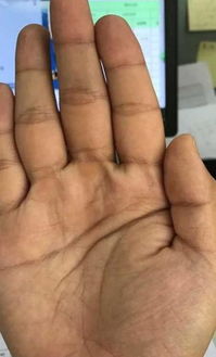 测试皮肤三角纹多(三角纹什么样),第2张 测试皮肤三角纹多(三角纹什么样),测试皮肤三角纹多(三角纹什么样),第2张